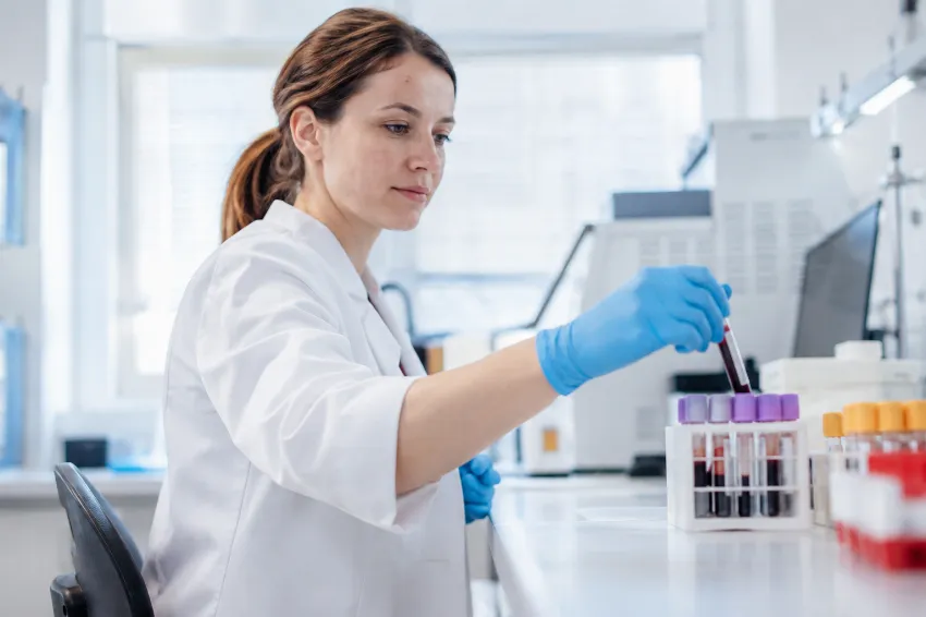 Laboratorijska meritev ravni vitamina D v krvi